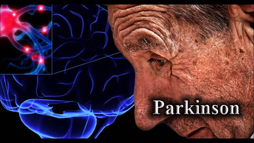 В России создан отечественный препарат для лечения болезни Паркинсона