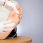 4–15% людей с диабетом сталкиваются с хроническими ранами на ногах
